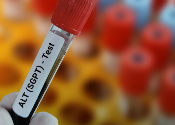 ALT Podwyższone: Co Musisz Wiedzieć