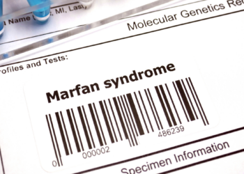 Zespół Marfana to genetycznie uwarunkowane zaburzenie
