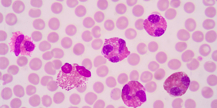 Eozynofile w przybliżeniu mikroskopijnym